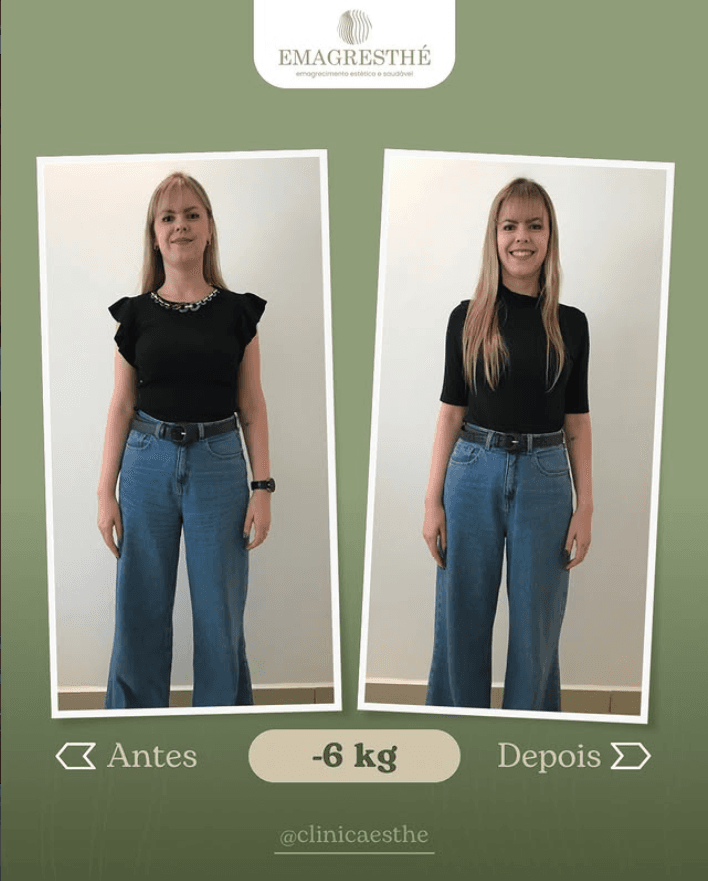 Antes e depois do programa Emagresthe em Curitiba: menos 6 kg