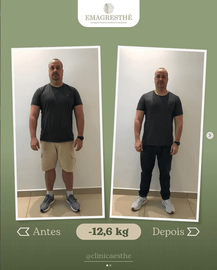 Antes e depois do programa Emagresthe em Curitiba: menos 12,6 kg